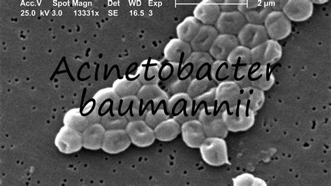 How to Pronounce Acinetobacter baumannii .